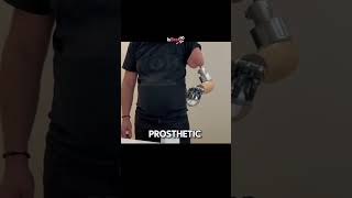 Amazing technology prosthetics artificiallimb prostheticarm prosthetichand bioniclimbs [upl. by Mcdermott106]