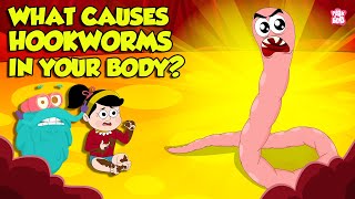 What causes Hookworm। Intestinal Worms Symptoms and Treatment  Worm Infection  Dr Binocs Show [upl. by Nnanerak]