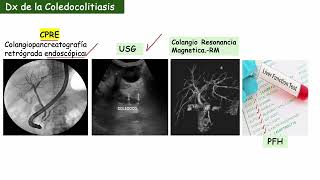 Anatomía del Colédoco [upl. by Ailahs216]