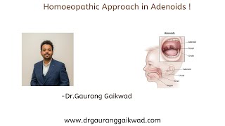 Homoeopathic Approach in Adenoids [upl. by Bilek120]