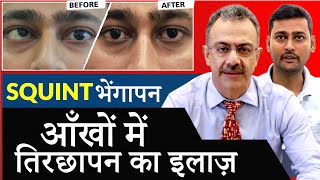 भेंगापन तीरछापन का इलाज  Near LIVE Squint Surgery Demonstration [upl. by Radley153]