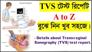 TVS টেস্ট রির্পোট বুঝার সহজ উপায়। How to read Transvaginal ultrasound or TVS test report TVS test [upl. by Essyle]