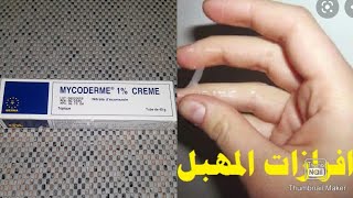 كريم mycoderm العلاج النهائي لحكة المهبل ومشاكل جلدية اخرى مع طريقة استعمال وداعا للافرازات المهبلية [upl. by Branden]