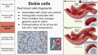 Red Blood Cell Morphological Abnormalities [upl. by Shepley962]