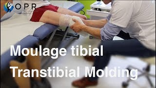 Moulage tibial pour la fabrication d’une prothèse à OPR BretagneNormandie [upl. by Anelam]