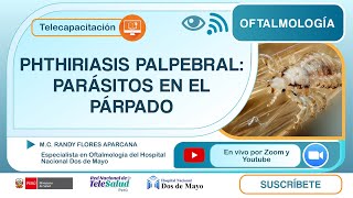 PHTHIRIASIS PALPEBRAL DIAGNÓSTICO Y TRATAMIENTO [upl. by Enelegna]