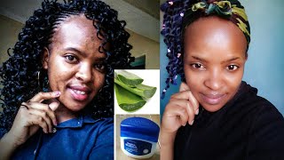 How I Removed Pimples and Blackspots Using Aloe Vera and Vaseline Arielskecher Art [upl. by Ainosal844]