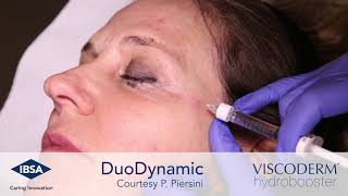 Viscoderm Hydrobooster DuoDynamic Technique Periocular Area [upl. by Vigen805]