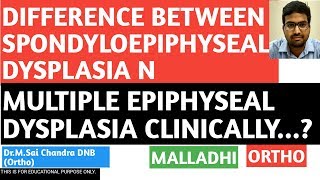 DIFF BETWEEN SPONDYLOEPIPHYSEAL AND MULTIPLE EPIPHYSEAL DYSPLASIA [upl. by Mccormick]