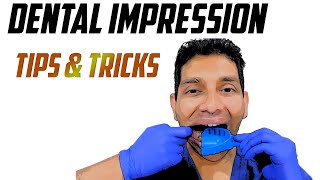 Dental Impression Taking Tips amp Tricks [upl. by Lorain600]