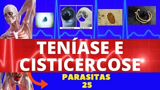 TENÍASE E CISTICERCOSE  TÊNIA SOLIUM E TÊNIA SARGINATA SOLITÁRIA  PARASITOLOGIA  INFECTOLOGIA [upl. by Yorled970]