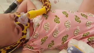 Baby sleeping with a CPAP machine [upl. by Turnbull]