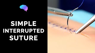 Simple interrupted suture wound suturing  OSCE Guide  UKMLA  CPSA [upl. by Honoria95]