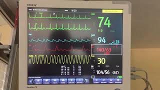 Monitoreo hemodinámico [upl. by Nitsej]