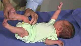 physical exam Newborn Normal TonePopliteal Angle [upl. by Notac]