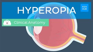 Farsightedness Hyperopia Definition causes symptoms diagnosis and treatment  Kenhub [upl. by Ahsilrae]