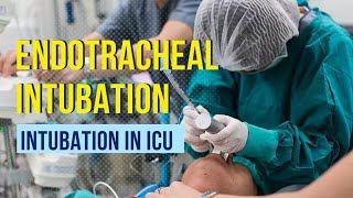 Endotracheal intubation Step by step procedure [upl. by Aileahcim]