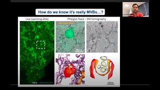 Liveimaging approaches to explore exosome biology in vitro and in vivo by Frederik Verweij [upl. by Onidranreb552]