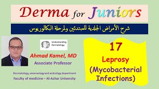 017 Leprosy Mycobacterial Infections د أحمد كامل [upl. by Attej]