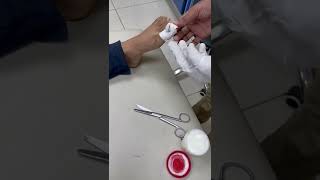 Demo20 Application of 40 Urea ointment to soften hyperkeratotic nail in Onychographosis [upl. by Nekciv25]