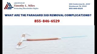 ParaGard IUD Removal Side Effects Lawsuit [upl. by Hammerskjold]