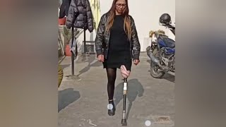 The beautiful amputee woman challenges disability with an artificial leg ampute [upl. by Ridgley]