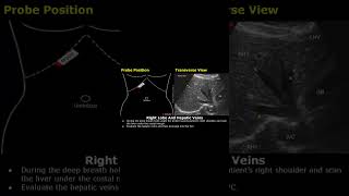 Right Liver Lobe amp Hepatic Veins Probe Positioning  Ultrasound Transducer Placement USG shorts [upl. by Roche]