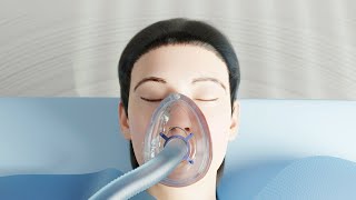 Cardinal Health™ Gen II Anesthesia Masks [upl. by Aniratac]