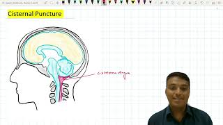 Cisternal Puncture  Suboccipital Puncture [upl. by Norga]