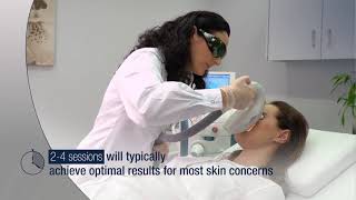 IPL Photofacial with Lumenis M22 at IGBeauty Laser amp Skin Clinic [upl. by Abott]