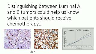 2023 Classic Lectures in Pathology What You Need to Know Breast Pathology [upl. by Sosanna65]