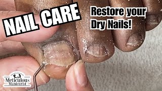 Nail Care Dry Toenails nails satisfying 🤤 [upl. by Nydnarb]