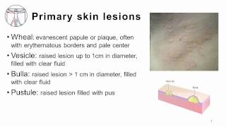 4 Primary and Secondary skin lesions [upl. by Leasi]