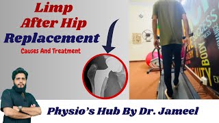 Limping walk After Hip Replacement Discover Cause and Top Exercises [upl. by Allista]