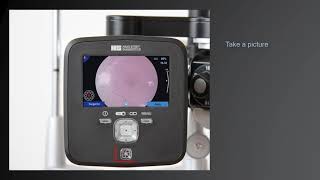 Tip Instructional – Portable Fundus Module 300 [upl. by Jeavons591]