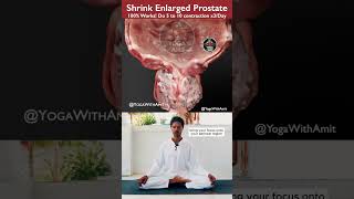 Shrink Enlarged Prostate shrinking enlargedprostate yogawithamit [upl. by Onairotciv867]