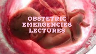 OBSTETRIC EMERGENCIES lecture 1 ANTEPARTUM HEMORRAHGE placental abruption and previa made simple [upl. by Vatsug]