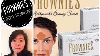 FROWNIES Reduce Frown Lines Wrinkles Facial Pads Forehead amp Btw Eyes  effortlessruth [upl. by Hansen394]