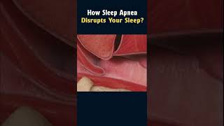 What Sleep Apnea Sounds Like 🥴 deepsleep [upl. by Ennovyahs]