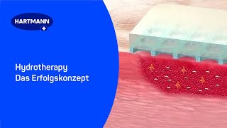 Hydrotherapy  Das Erfolgskonzept [upl. by Eugnimod]