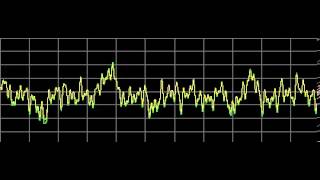 Candidiasis Candida Albicans  Rife Frequencies [upl. by Aniri]