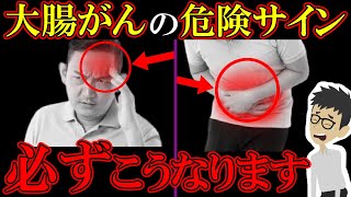 放置厳禁！知らないと後悔する大腸がんの危険な症状4選！【大腸癌｜初期症状｜ステージ｜検査｜ガン｜悪性新生物｜原因｜ポリープ】 [upl. by Neelahs]