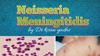 Microbiology lectureNeisseria Meningitidis  disease symptoms pathogenesisdiagnosis treatment [upl. by Orelu]