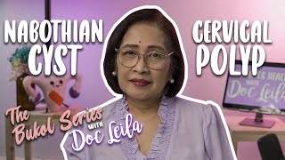 CERVICAL POLYP amp NABOTHIAN CYST THE BUKOL SERIES EP 2 with Doc Leila OBGYNE Philippines [upl. by Edylc475]