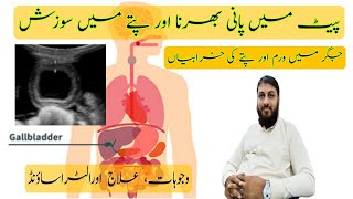 Gallbladder wall thickness Hindi Urdu [upl. by Einnos666]