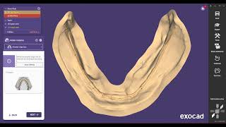 Designing complete dentures with Exocad Denture Module [upl. by Nirret]