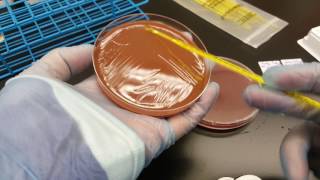 Microbiology How to perform a Primary Set up from a Positive Blood Culture [upl. by Aimac972]