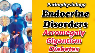 The pathophysiology of ENDOCRINE SYSTEM  Acromagaly amp Giganstism Diabetes type I amp type II  Tutor [upl. by Meela]