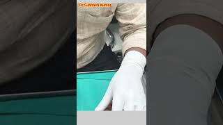 How Lignocaine Is Given Xylocaine कैसे दिया जाता है drsubhashkumar anaesthesia [upl. by Aicetel672]