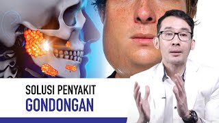 Gondongan Gejala Penyebab dan Cara Mengatasi  Kata Dokter [upl. by Enillebyam]